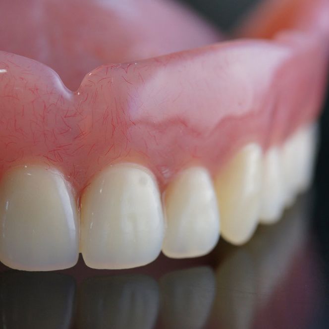 Dentures on a black surface.